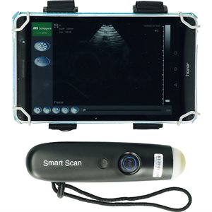 MS SMARTSCAN 3.0 (A)